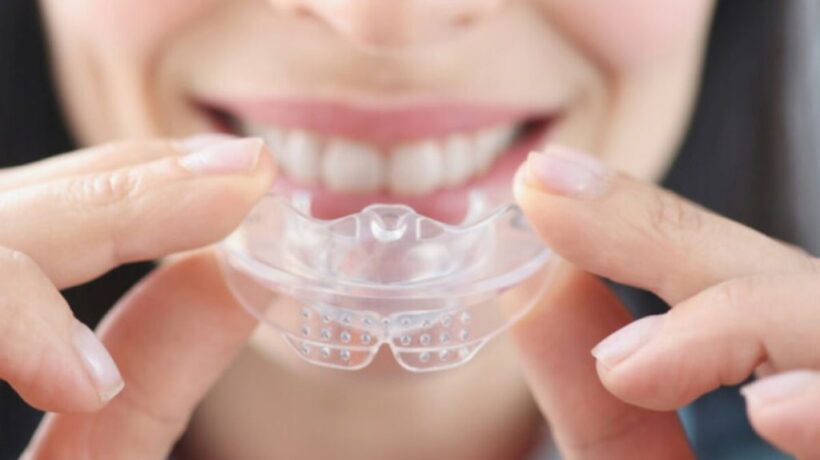 How to Keep Your Mouth Guard Fresh: Simple Steps for a Healthier Smile